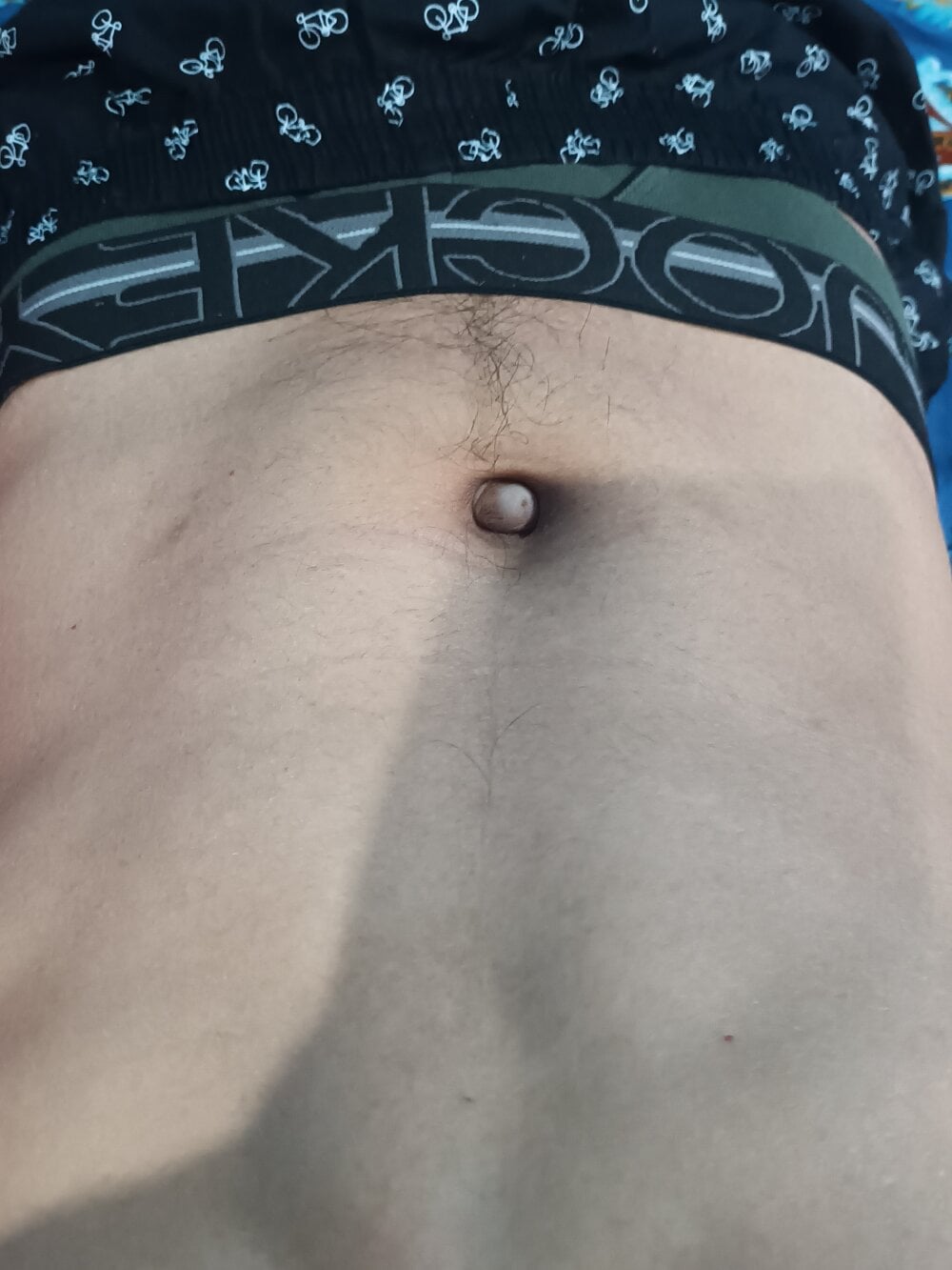 BlenchedSprain Chatroom